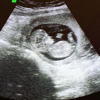 Futuras Mamas Julio 2020. - 1