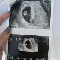 Futuras mamis septiembre 2022!!🤰 - 1