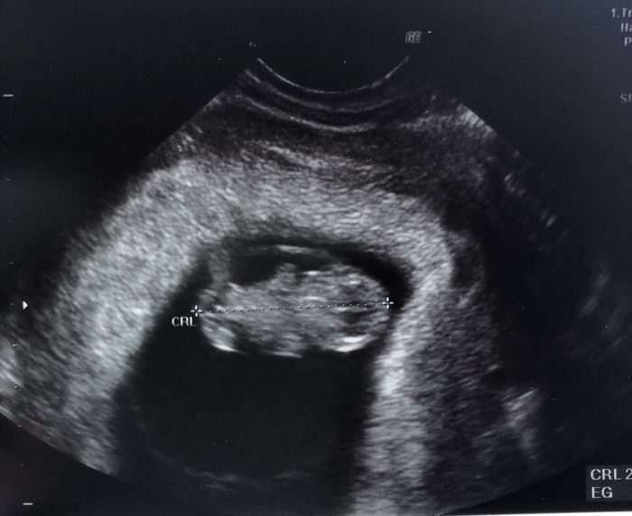 Futuras mamás Diciembre 2018 - 1
