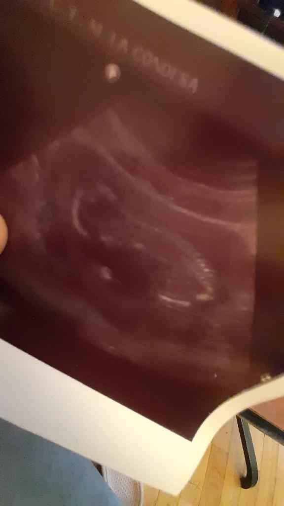 Ayuda con método ramzi: niño o niña? 7