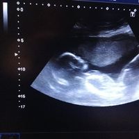 Futuras mamis diciembre 2019 oficial - 1
