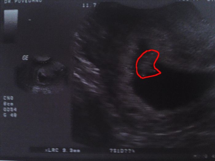  :D mi bebe guapisimo 