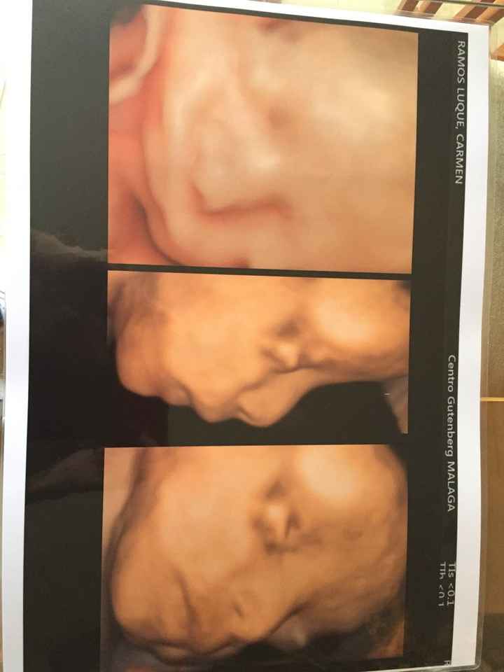 Mamis julio 2017 - 1