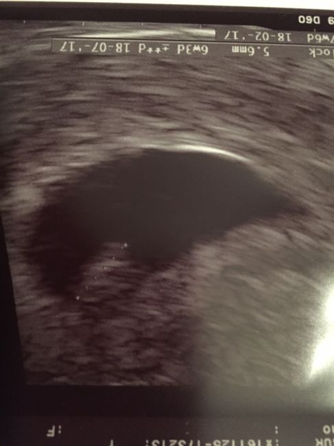 Mamis julio 2017 1