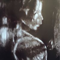Mamis julio 2017 - 1