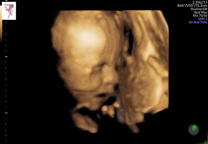 Futuras mamis Febrero 2021 - 1