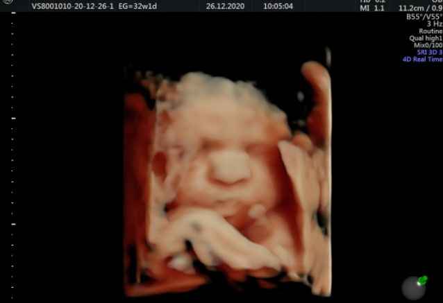 Futuras mamis Febrero 2021 - 1