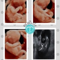 Futuras Mamas Julio 2020. - 1