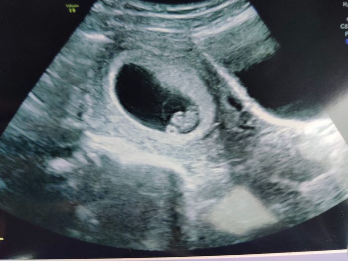 Futuras Mamis Enero 2021 - 1
