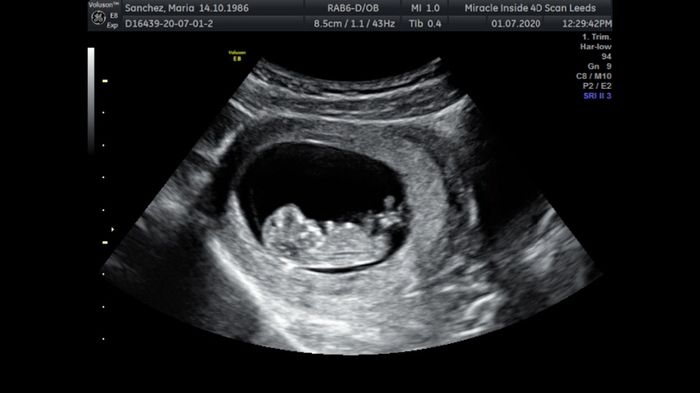 Futuras Mamis Enero 2021 - 1