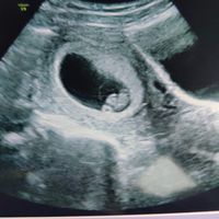 Futuras Mamis Enero 2021 - 1