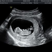 Futuras Mamis Enero 2021 - 1