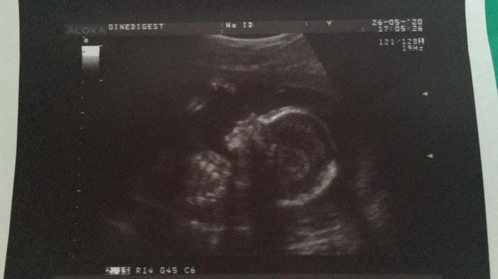 Futuras mamas octubre 2020 - 1
