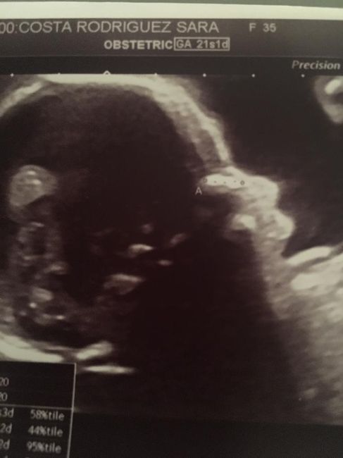 Futuras mamas octubre 2020 - 1