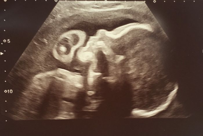 Futuras mamas octubre 2020 - 1