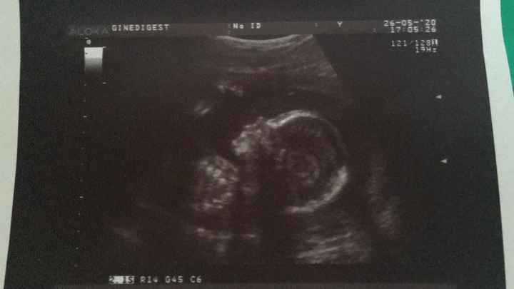Futuras mamas octubre 2020 - 1