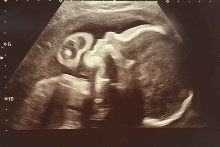 Futuras mamas octubre 2020 - 1