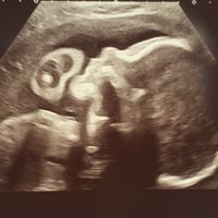 Futuras mamas octubre 2020 - 1