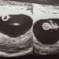 eco vaginal 8+2