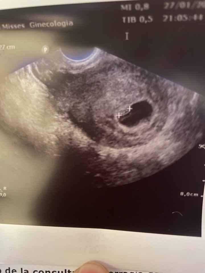 Futuras mamis septiembre 2022!!🤰 - 1