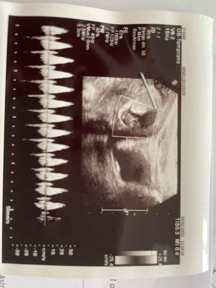 Futuras mamis septiembre 2022!!🤰 - 1