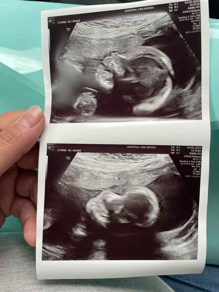 Futuras mamis septiembre 2022!!🤰 - 1