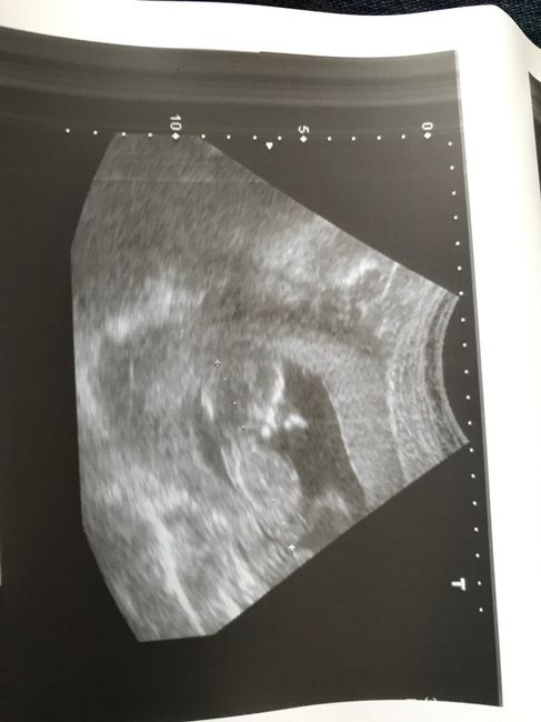 Nuevo! futuras mamis noviembre 2017 1