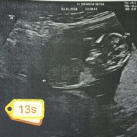  Futuras Mamis Julio 2018 - 1
