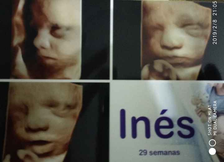 Ayer me hice una 5d, aquí os dejo a mi niña, aunque creo q estás ecos todos los bebés son iguales je