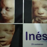 Ayer me hice una 5d, aquí os dejo a mi niña, aunque creo q estás ecos todos los bebés son iguales je