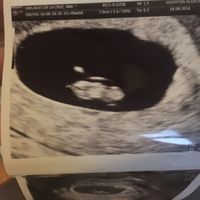 Futuras mamás abril 2017 - 1
