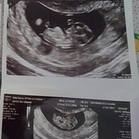 Ayuda con método ramzi: niño o niña? - 1