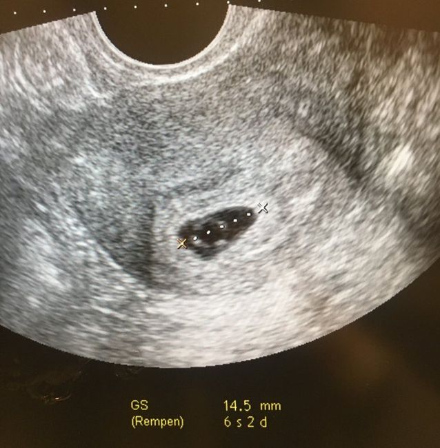 Futuras mamás agosto 2018 1