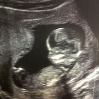 El consultorio de Lita para futuras mamis - 1