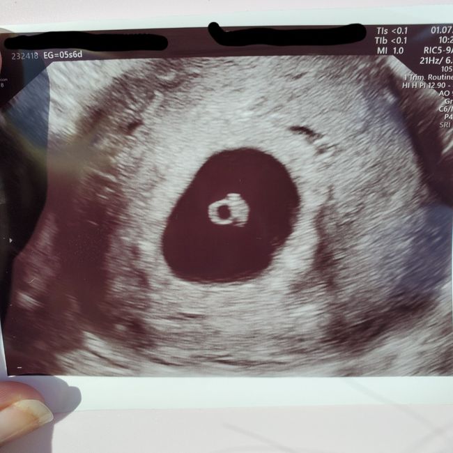 👶🏻futuras mamis febrero 2022👶🏻 1