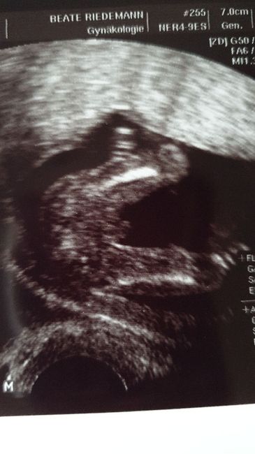 Mamis mayo 2020 v2.0 - 2