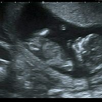  Futuras mamás agosto 2018 - 1