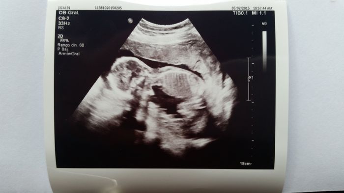 19 semanas