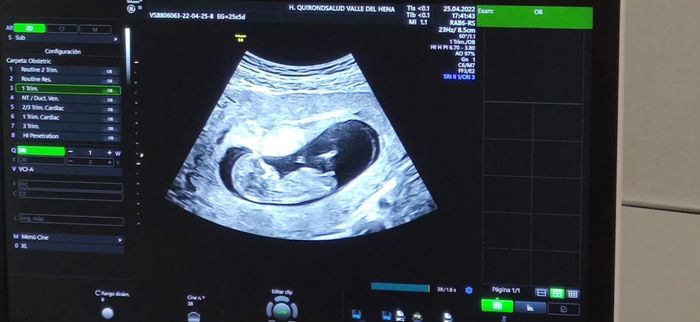 Futuras mamis noviembre 2022 - 1