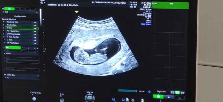 Futuras mamis noviembre 2022 - 1