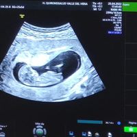 Futuras mamis noviembre 2022 - 1