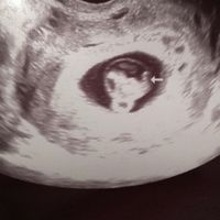 Mamis septiembre 2017 - 2