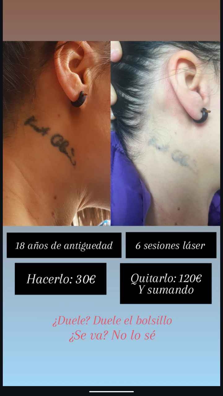 Eliminar un tatuaje - 1