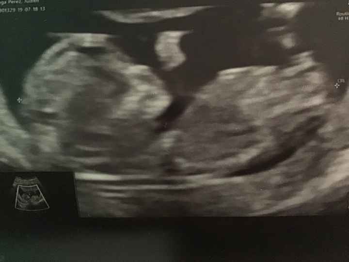 Mi bebe¡¡