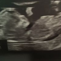 Mi bebe¡¡