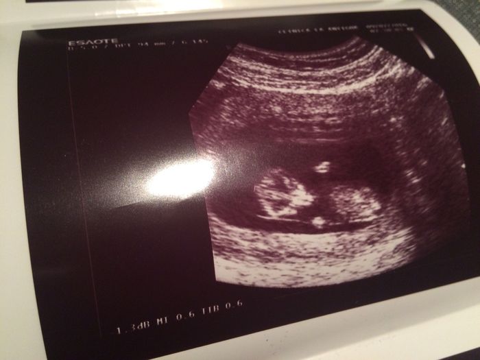 Futuras mamas febrero 2017 - 2