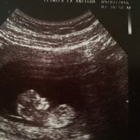 Futuras mamas febrero 2017 - 1