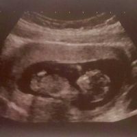 Futuras mamas febrero 2017 - 2