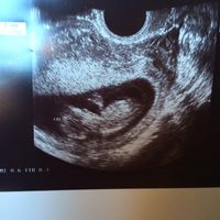 Futuras mamas febrero 2017 - 3