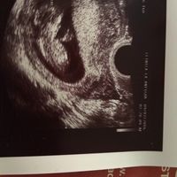 Futuras mamas febrero 2017 - 4